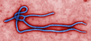 Ebola close-up